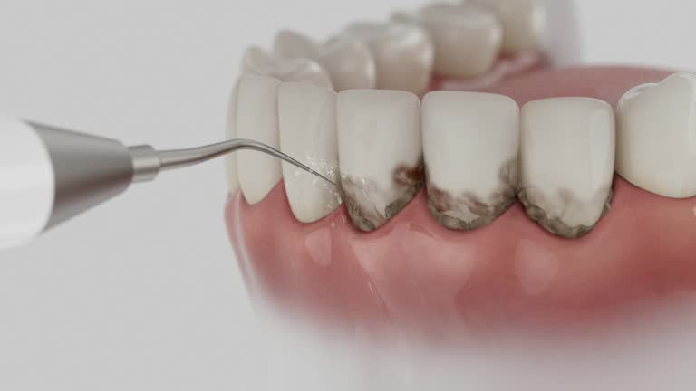 Trusted Dental Implants service in Anthony, KS - Dentist Open Now